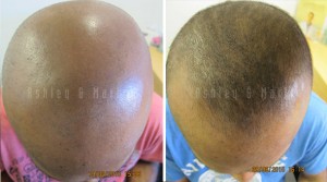 2107-SEO-Content-Jul-15---preventing-hair-loss 